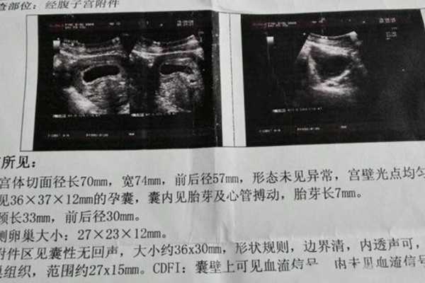 2022上海仁济医院可以做供卵试管婴儿吗?-代孕医院好不好
