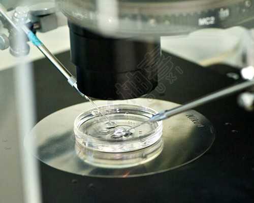 广西试管代生方案 广西壮族自治区妇幼保健院 ‘双顶径看男女准不’