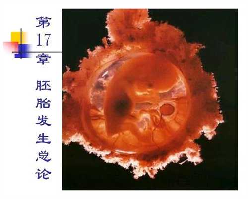 代孕胎儿异常情况有哪些 最常见的三种胎儿异常