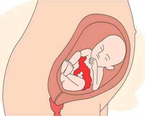 广州代孕辅助生殖中心费用_广州2021最新代孕价格_哪里有代生小孩女人_代孕团队哪里有