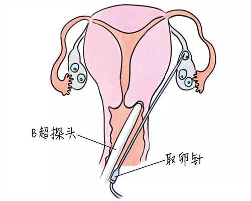 广州代孕中心费用_广州试管代孕的成功率_月经刚过可以洗澡吗
