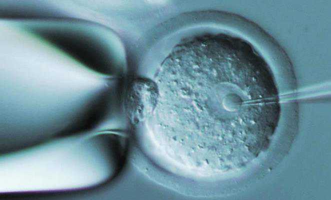 广西哪里供卵 2022广西壮族自治区生殖医院试管婴儿费用明细 ‘双胎b超怎样看